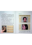 望診之基：頭面部五官各論